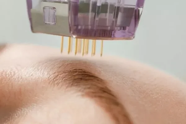 FDA Onaylı Altın İğne