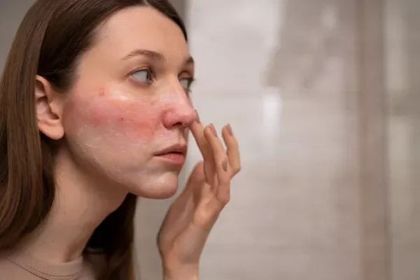 Cilt Yenileme Kürü