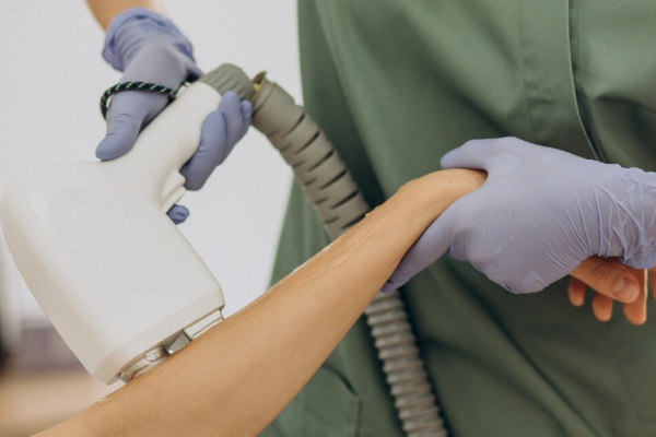 Cynosure Elite Epilasyon