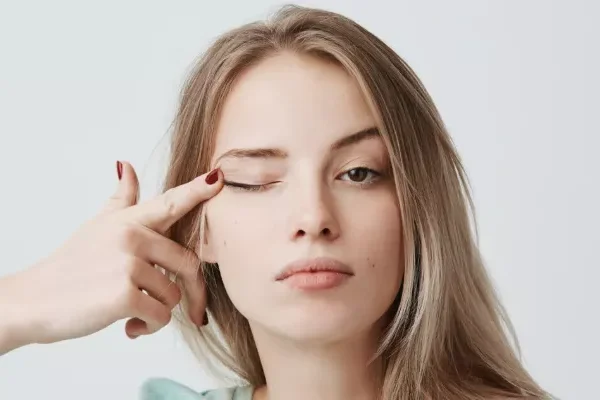 Göz Kapağı Alımı