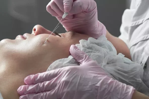 İğneli Mezoterapi