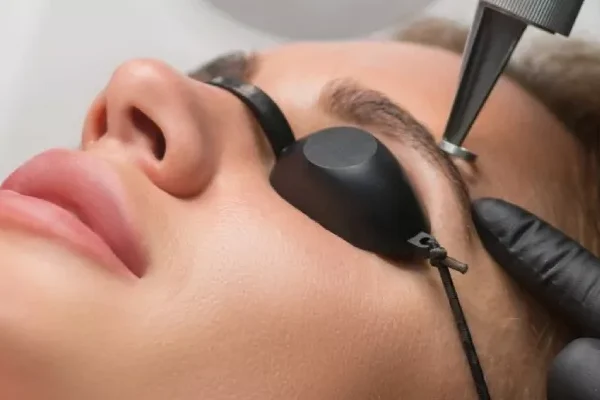 Kalıcı Kaş Dövmesi Silme