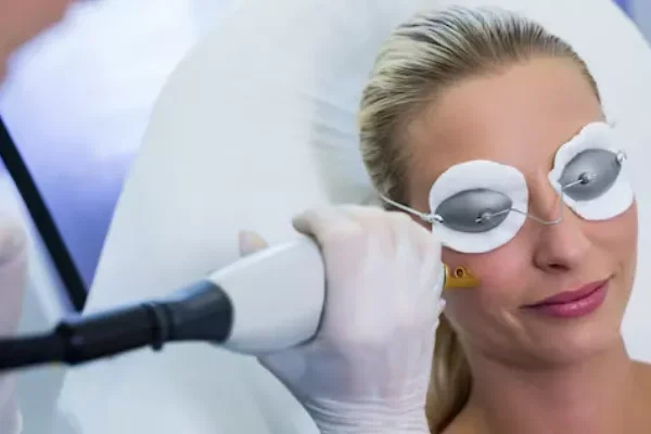 Lazerle Leke Tedavisi