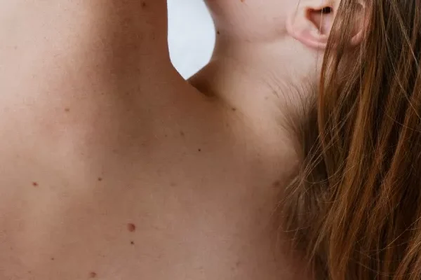 Plexr ile Ben Alımı